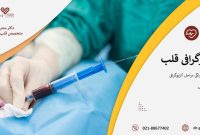 آنژیوگرافی به زبان ساده آنژیوگرافی به زبان ساده